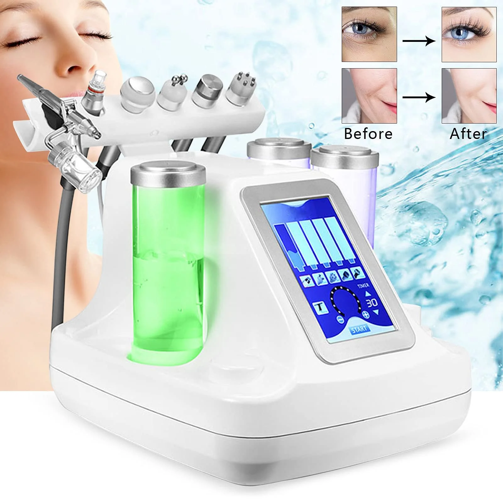 Апарат для гідродермабразії 6-в-1 Bio Light RF 150W Кисневе очищення, фото №3