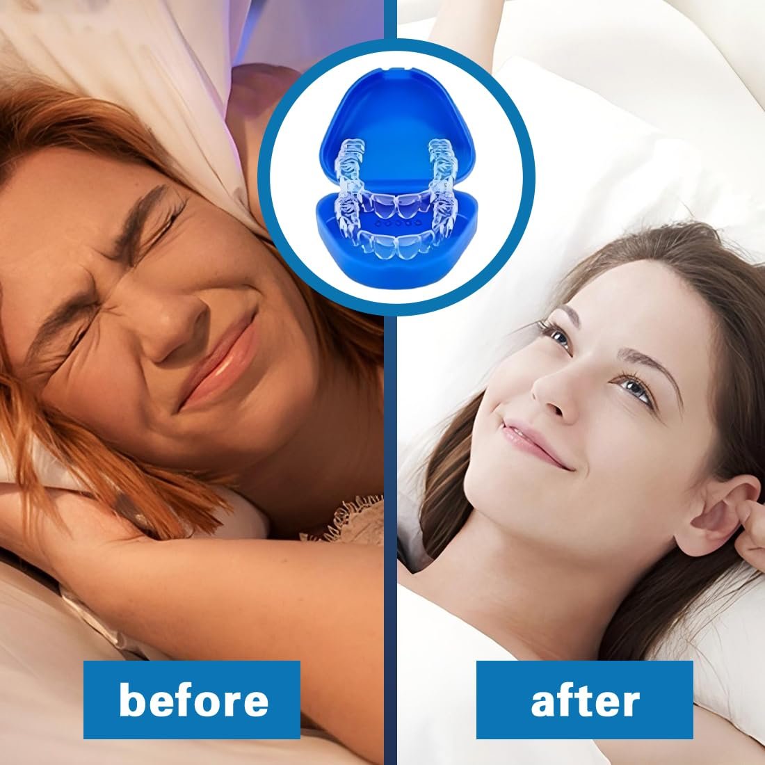 Капа від бруксизму 4 шт., Нічна , Багаторазова, фото №4 Капа від бруксизму 4 шт., Нічна , Багаторазова, фото №4