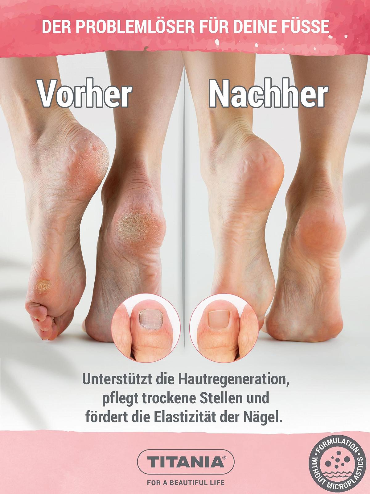 Бальзам для ног и ногтей TITANIA 100 мл С маслом ши авокадо и биотином веганский натуральный, фото №4