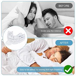 Капа от храпа, капа против храпа, регулируемая synthetic.ua - Фото 1