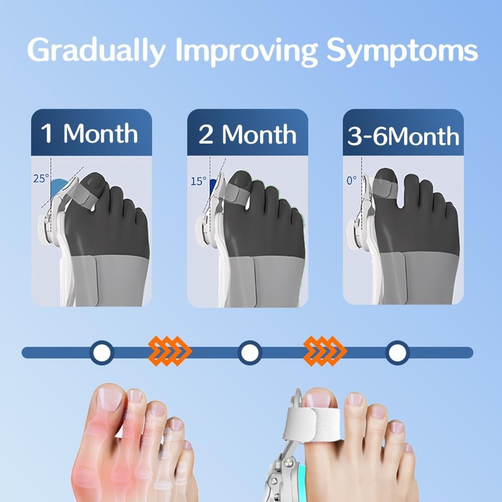 Шина для коррекции Hallux Valgus, регулируемая ортопедическая, фото №2
