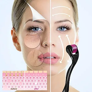 Дермароллер 540 голок 0.3 мм Нержавіюча сталь Чорний/Фіолетовий - Фото 1