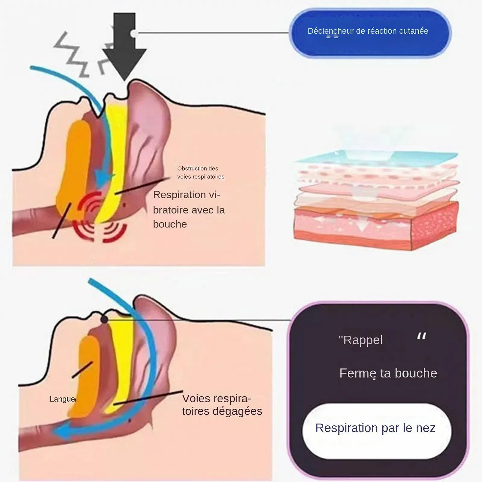 Смужка для рота проти хропіння, 400 шт., М'які, фото №4