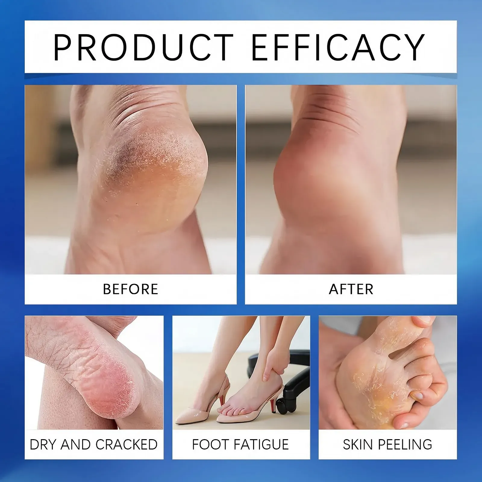 Крем для ног и рук Urea Cream 60% увлажняющий в стике 1.41 унции, фото №5 Крем для ног и рук Urea Cream 60% увлажняющий в стике 1.41 унции, фото №5