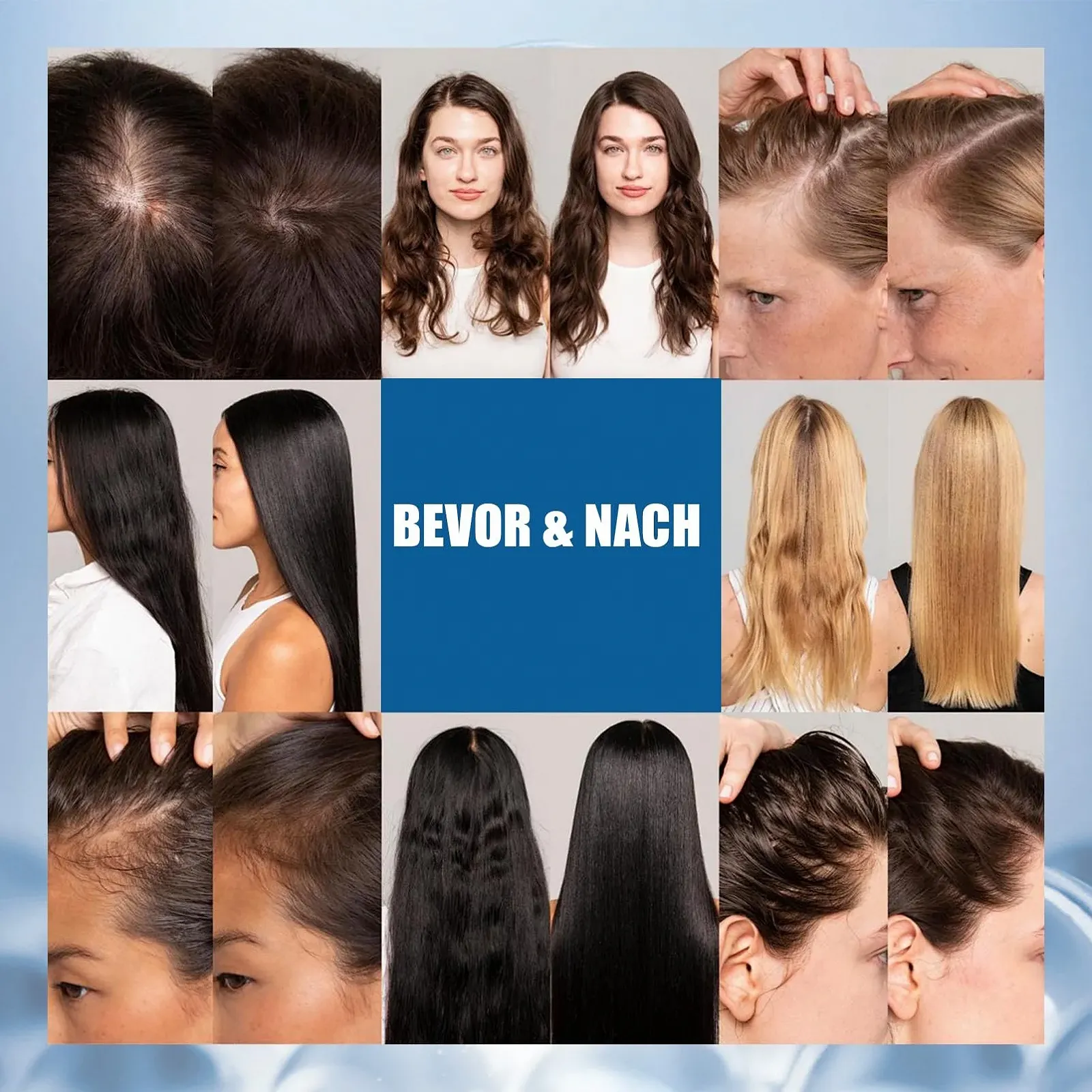 Ампула для волосся Scalphy, Охолоджуюча ампула для росту волосся, фото №6