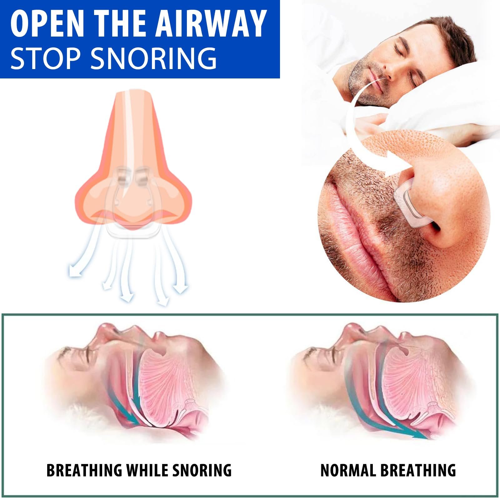 Кліпса проти хропіння Паковання з 6 стоперів, фото №4 Кліпса проти хропіння Паковання з 6 стоперів, фото №4