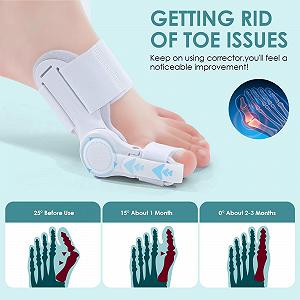 Коректор Hallux Valgus Регульований Hallux Valgus для великого пальця стопи Підтримка Hallux Valgus та корекції бурситу для чоловіків та жінок synthetic.ua - Фото 1