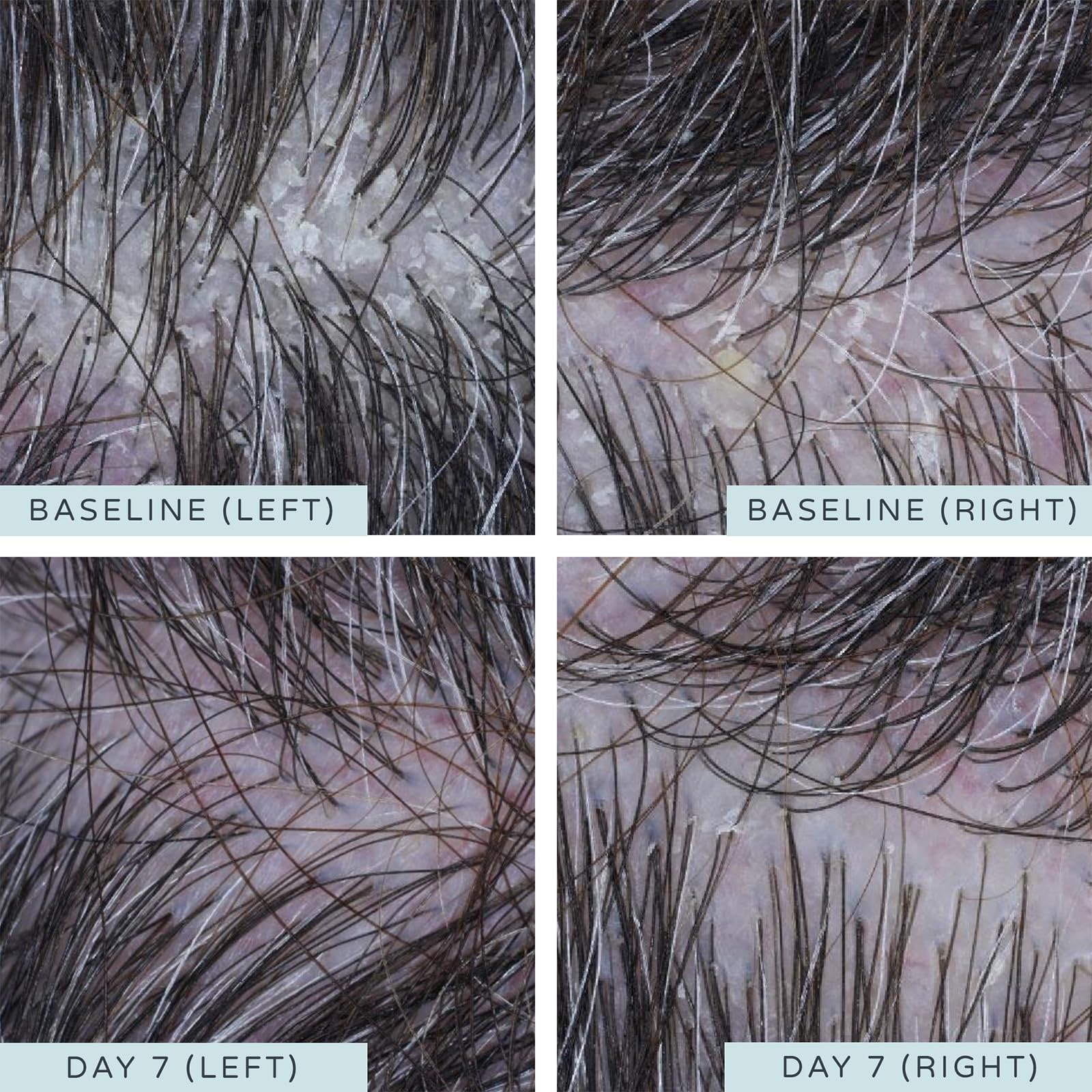 Кондиционер AMELIORATE Smoothing 250 мл, фото №3 Кондиционер AMELIORATE Smoothing 250 мл, фото №3