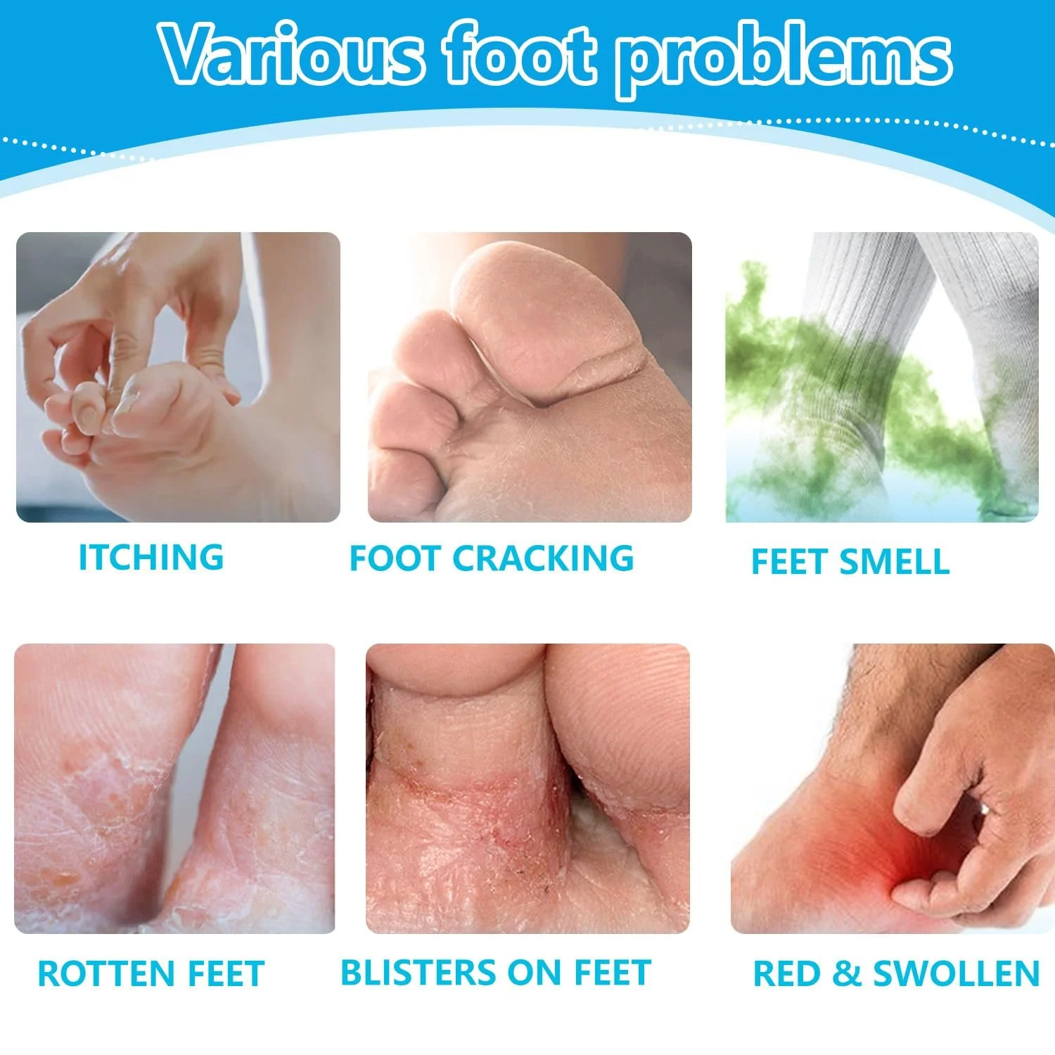 Гель для ног против грибка, зуда и запаха натуральный 2 шт., фото №4 Гель для ног против грибка, зуда и запаха натуральный 2 шт., фото №4