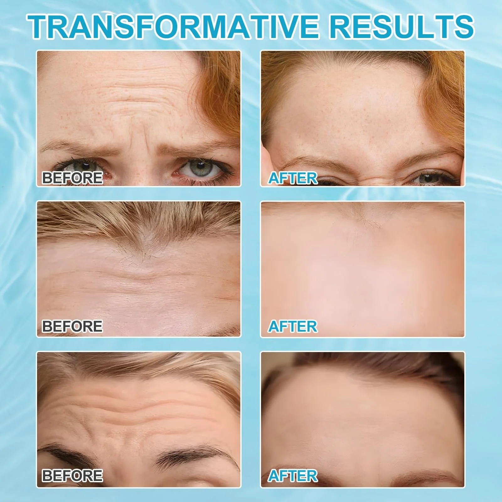 Патчі для лоба Anti-Falten-Stirnpflaster, 12 шт. - живильна суміш колагену та вітаміну Е, фото №5