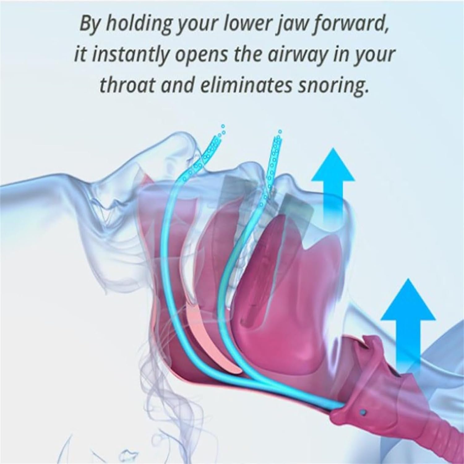 Тримач Язика Snoredestroy Силіконовий для покращення сну (5 шт), фото №8