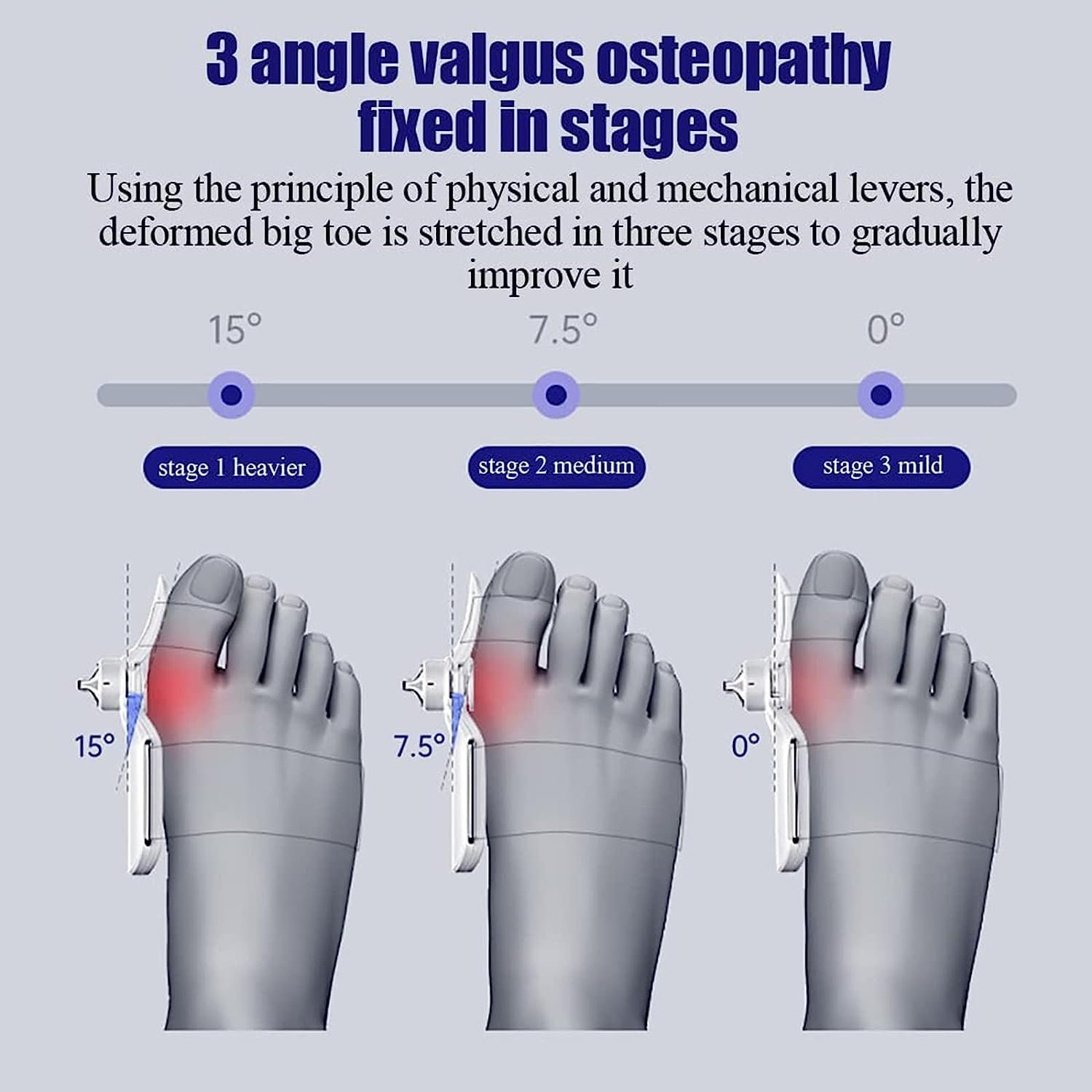Коректор великого пальця стопи для чоловіків і жінок з 3 кутовими фіксуючими пластинами, фото №3