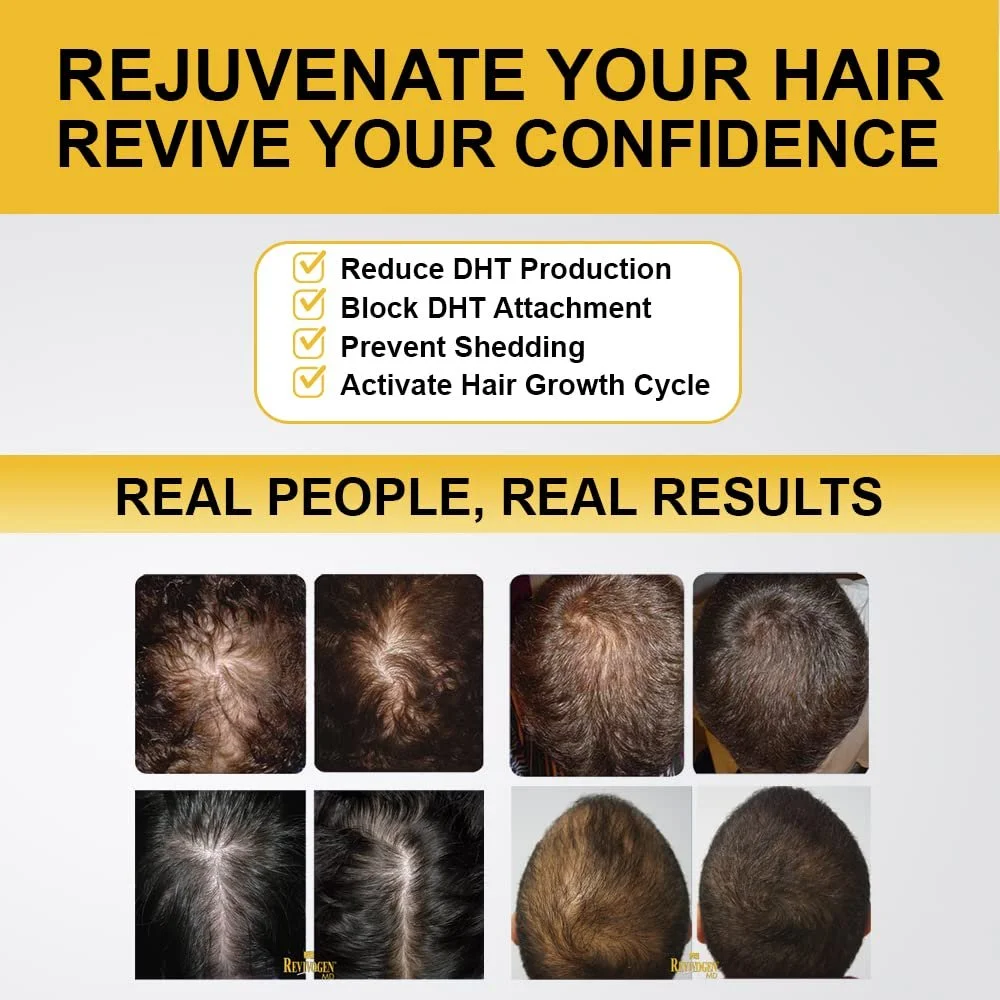 Засіб Revivogen Від випадіння волосся Revitalising Anti-DHT Formula, фото №5