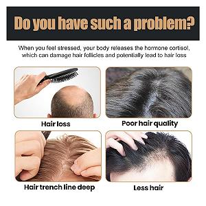 Шампунь Root Activator Hair Loss Thickening для відновлення волосся (натуральна формула), унісекс (2 одиниці) synthetic.ua - Фото 1