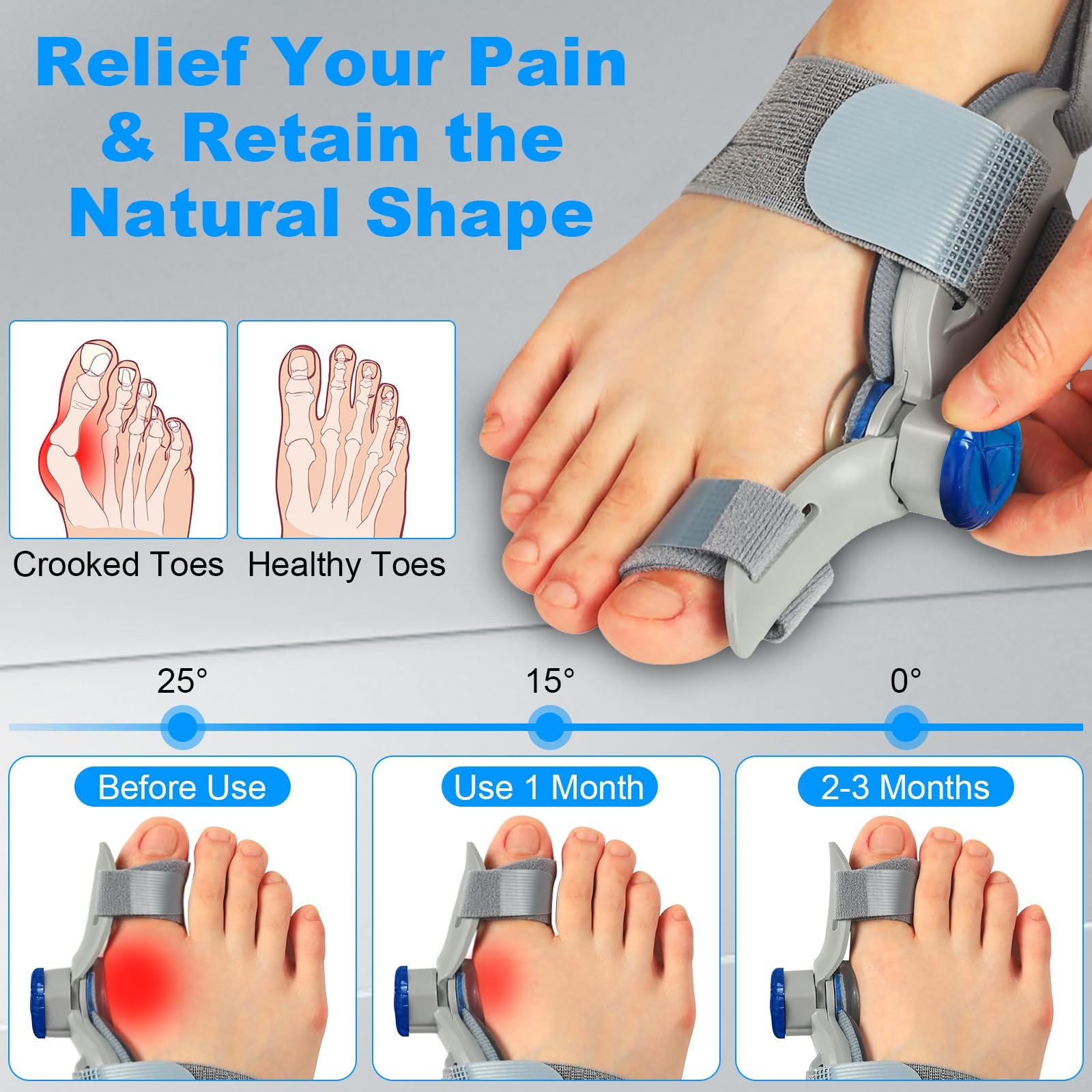 Шина для корекції Hallux Valgus LURICO з регульованою шиною та 2 силіконовими роздільниками для кісточок, фото №3