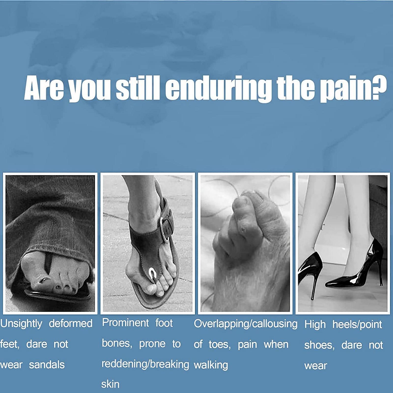 Ортопедичний коректор вальгусної деформації NLAVW, згинається для регулювання сили, міцний метал, що не легко деформується, фото №6