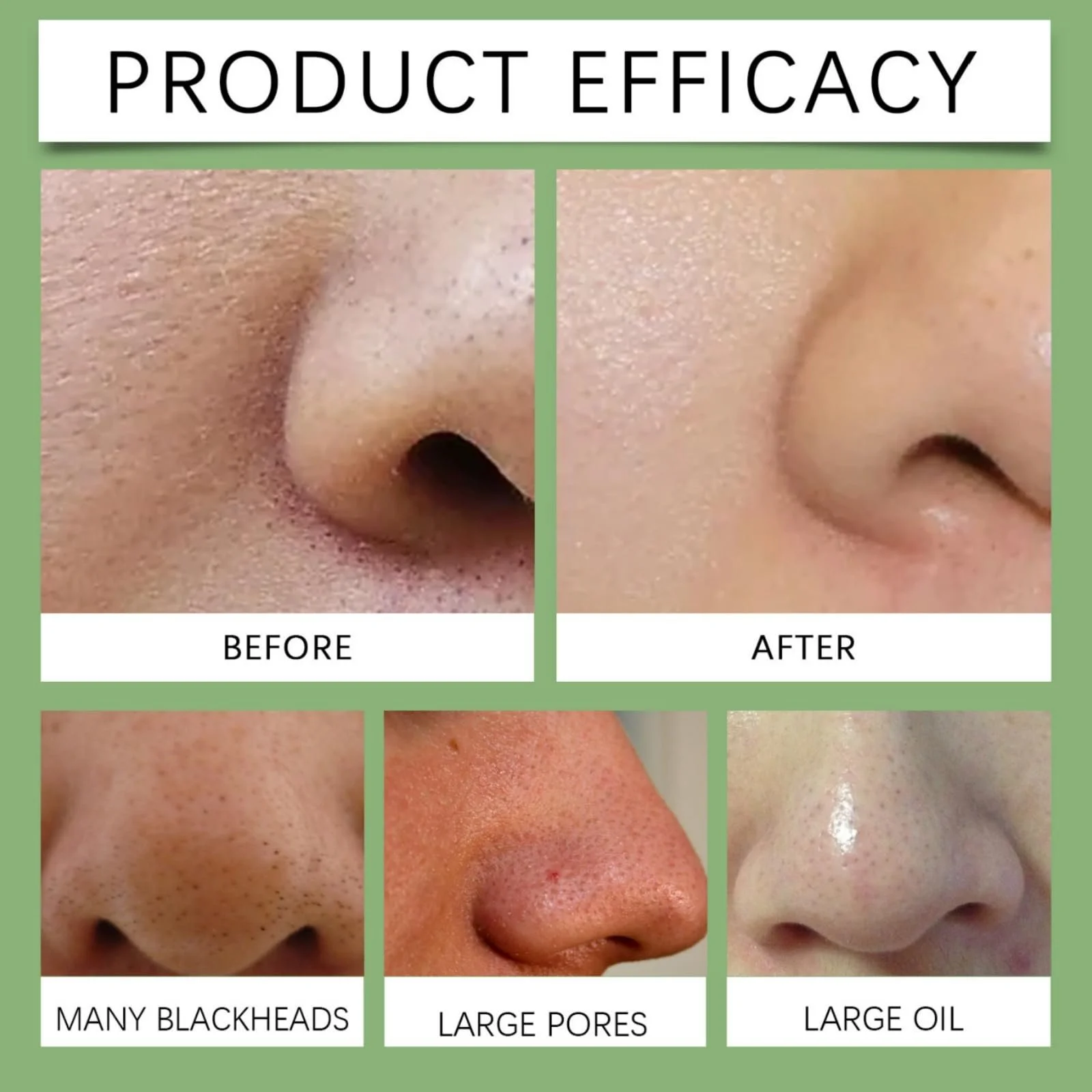 Маска для видалення чорних цяток (60 шт. в упаковці), смужки для глибокого очищення пор, фото №2 Маска для видалення чорних цяток (60 шт. в упаковці), смужки для глибокого очищення пор, фото №2