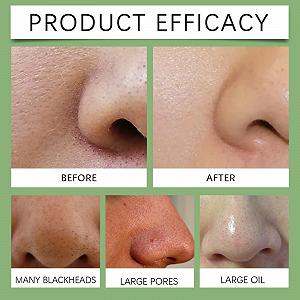 Маска для удаления черных точек (60 шт. в упаковке), полоски для пор, средство для глубокого очищения пор, средство для удаления черных точек с носа, маска-пленка для удаления черных точек, полоски для глубокой очистки пор для лица, средство для очищения пор лица synthetic.ua - Фото 1