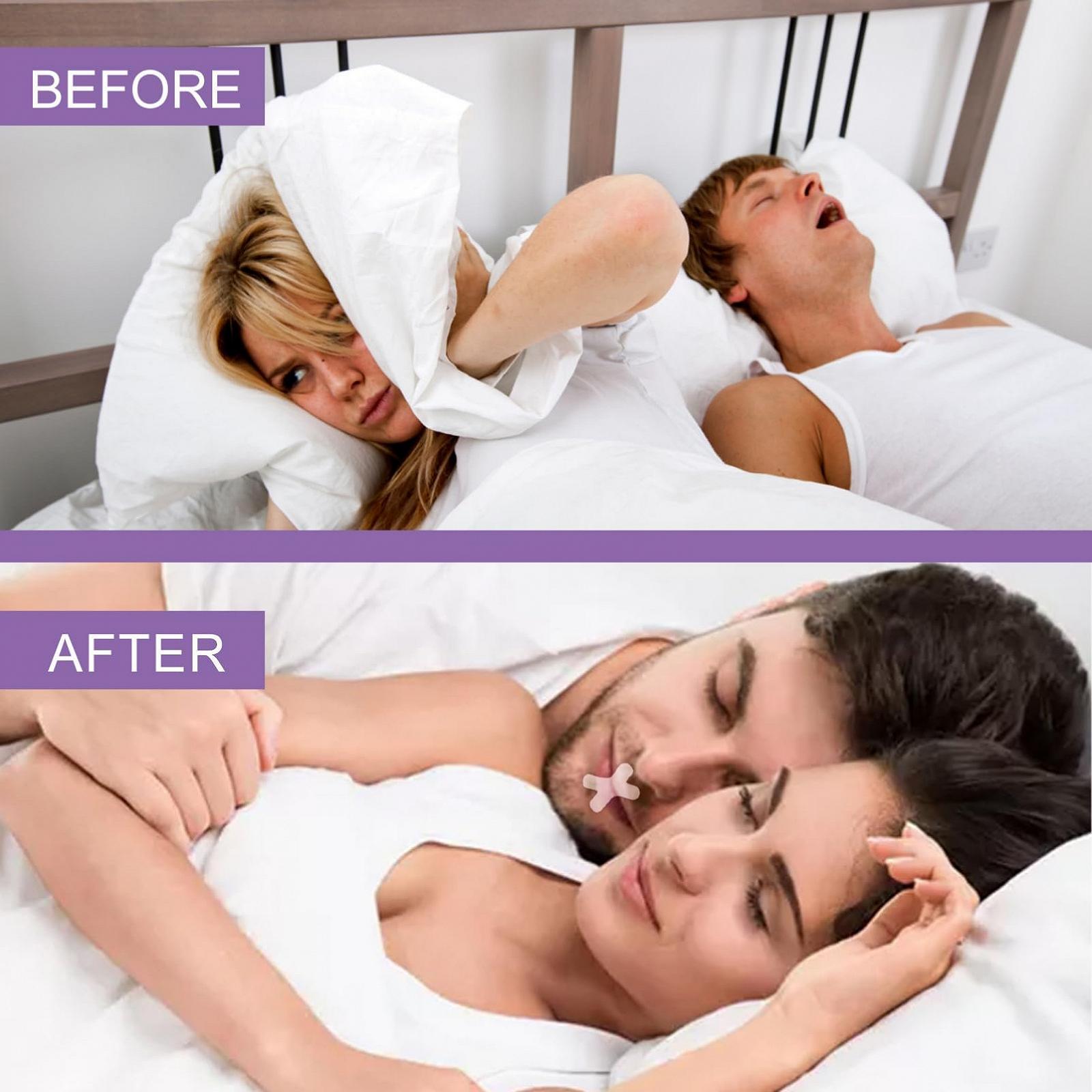 Пластирі від хропіння для сну, 120 шт, фото №6 Пластирі від хропіння для сну, 120 шт, фото №6