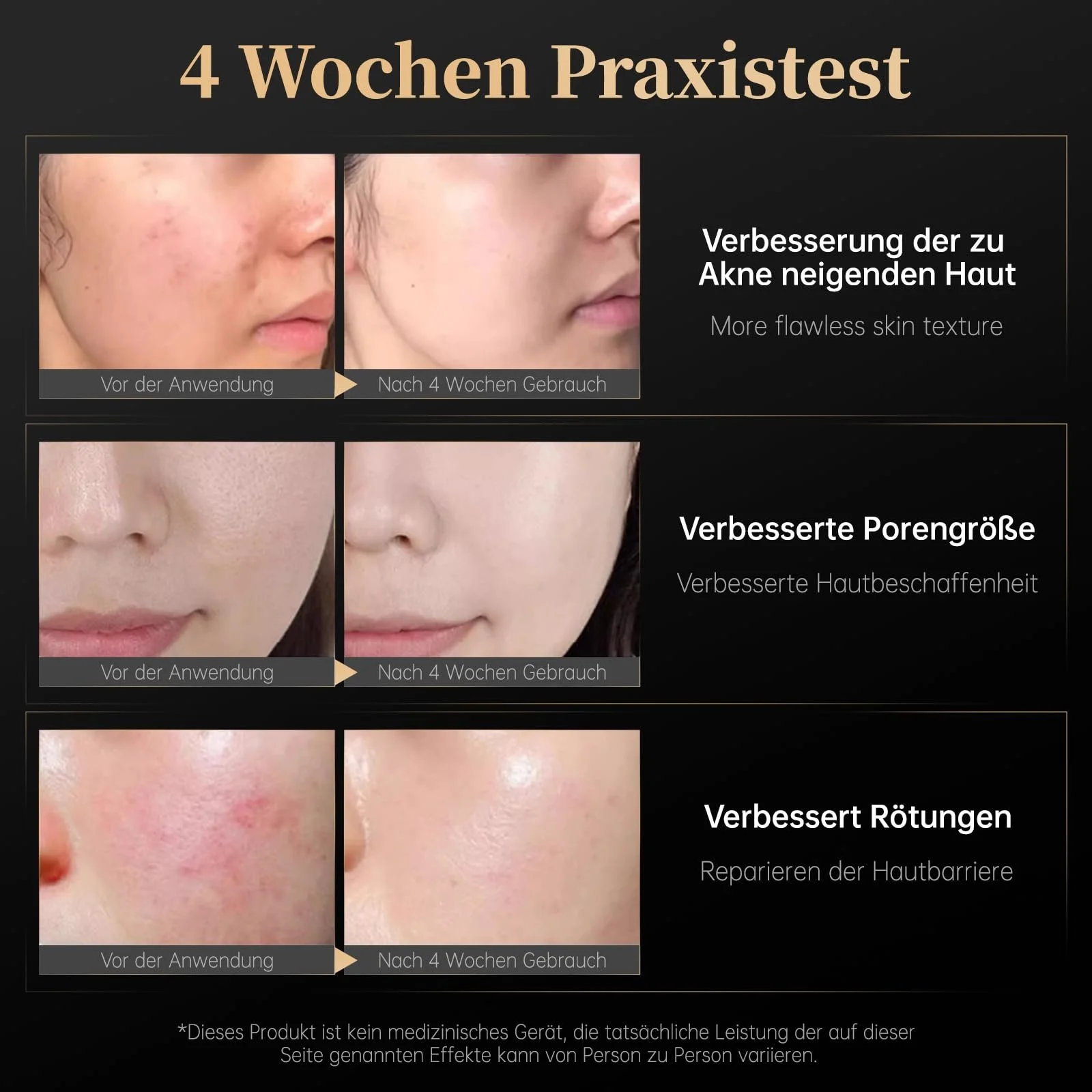 LED Маска для обличчя Світлотерапія з червоним світлом, 7 кольорів LED маска зі 110 потужними лампами, фото №7 LED Маска для обличчя Світлотерапія з червоним світлом, 7 кольорів LED маска зі 110 потужними лампами, фото №7