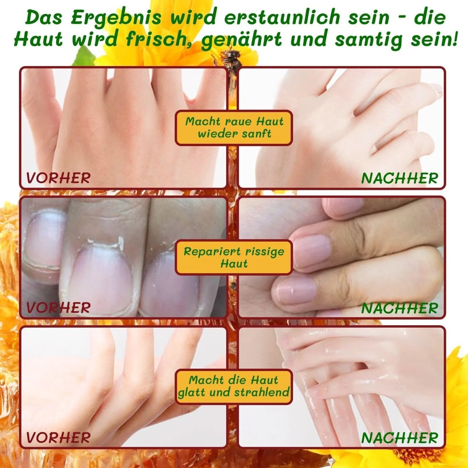 Маска для рук P-Beauty 5 пар с экстрактом меда и молока | Отшелушивающая маска | Крем и уход за руками | Антивозрастной эффект | Увлажняющие перчатки с витаминами, минералами и коллагеном | Для сухой, потрескавшейся кожи рук, фото №9