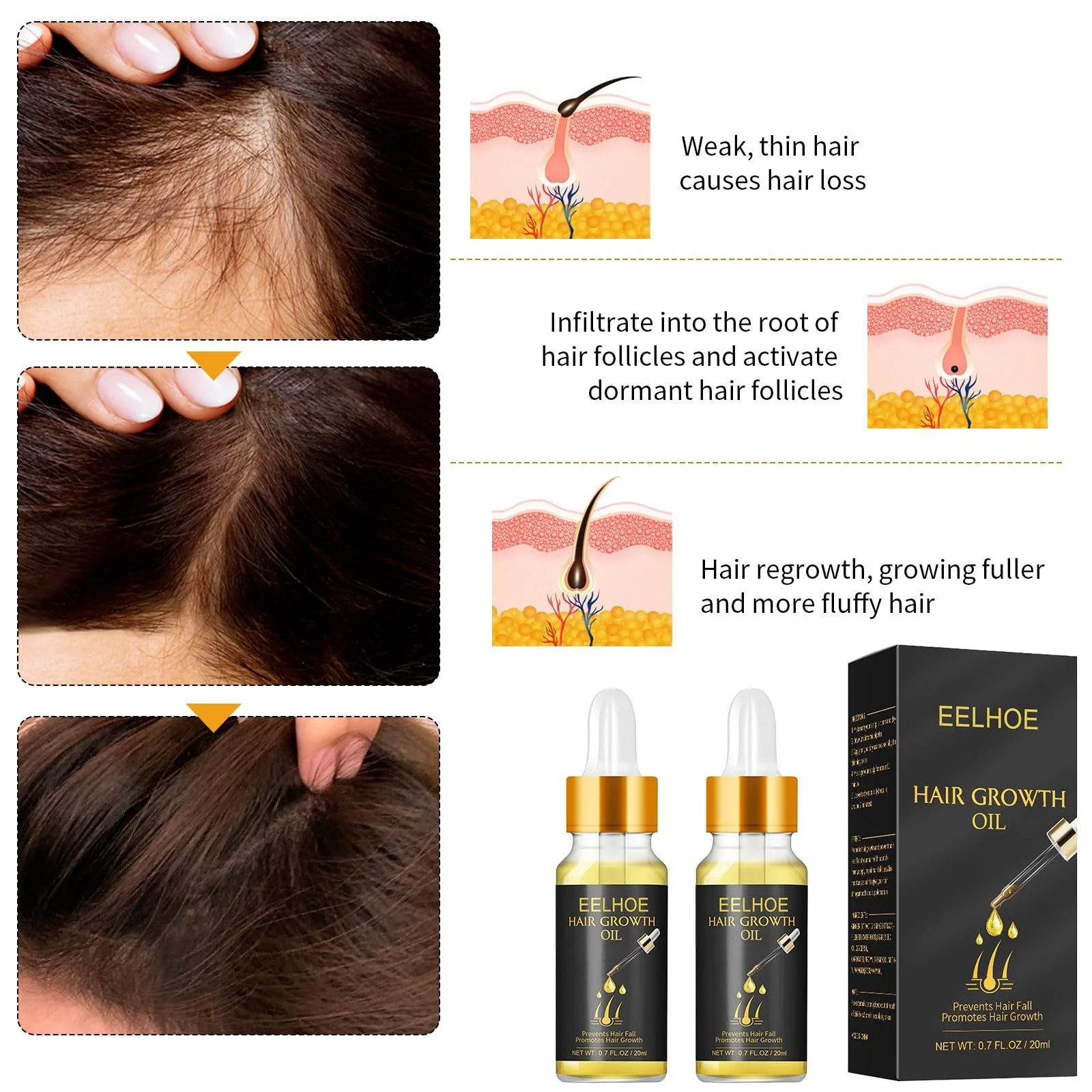 Сыворотка для роста волос 30 мл, 2 шт., фото №3