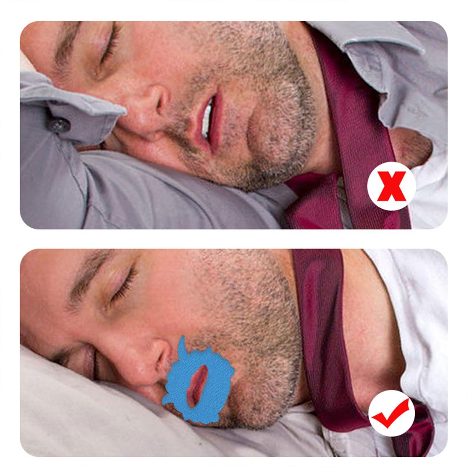 Смугасті Наліпки Від Хропіння, М’які та Зручні, Для Дорослих та Дітей, 10 шт в упаковці, фото №7 Смугасті Наліпки Від Хропіння, М’які та Зручні, Для Дорослих та Дітей, 10 шт в упаковці, фото №7