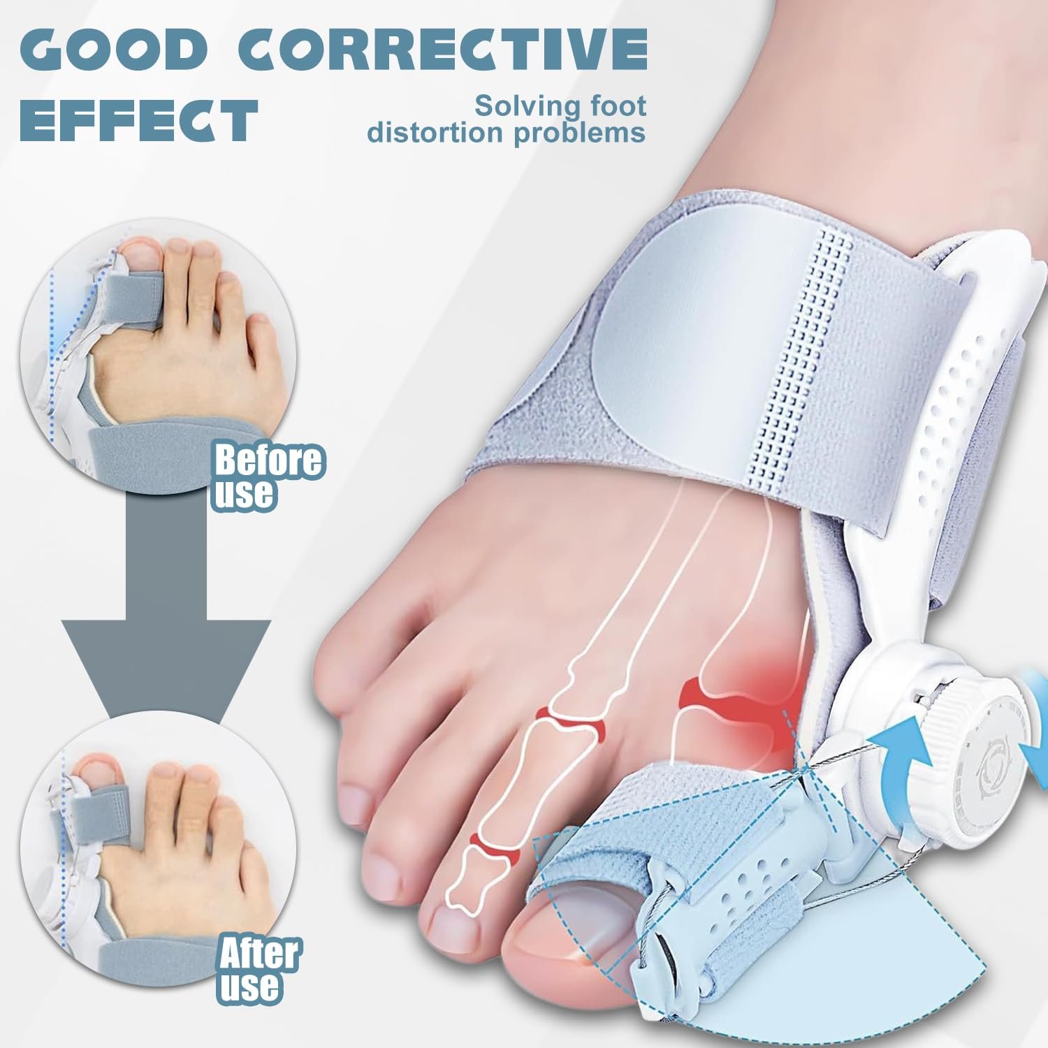 Шина для корекції Hallux Valgus, регульована, фото №5
