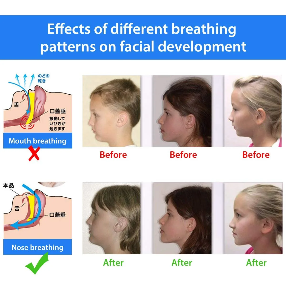 Смужки для носового дихання проти хропіння 60 шт., фото №3