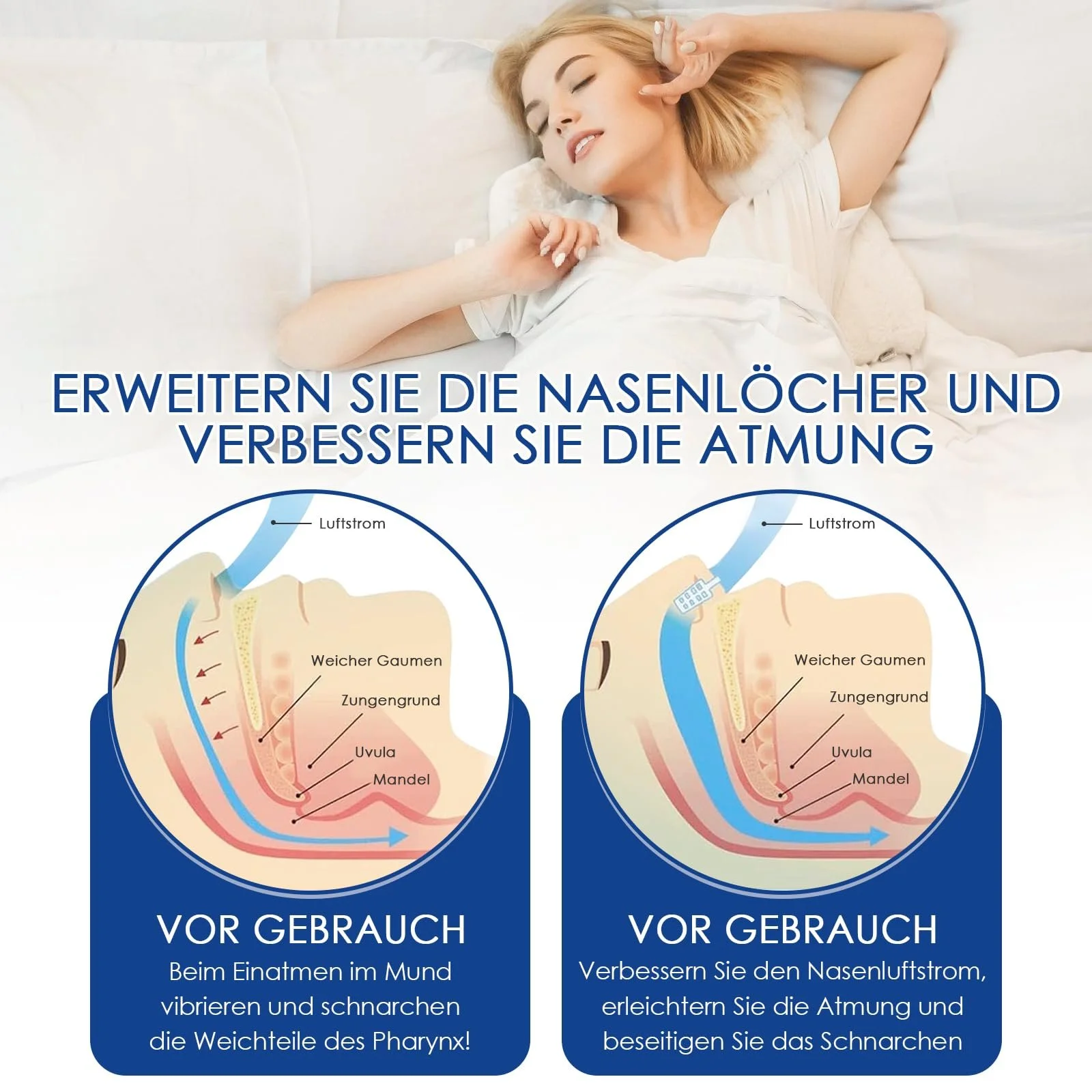 Распорка для носа (8 шт. в упаковке) для улучшения дыхания, фото №4 Распорка для носа (8 шт. в упаковке) для улучшения дыхания, фото №4