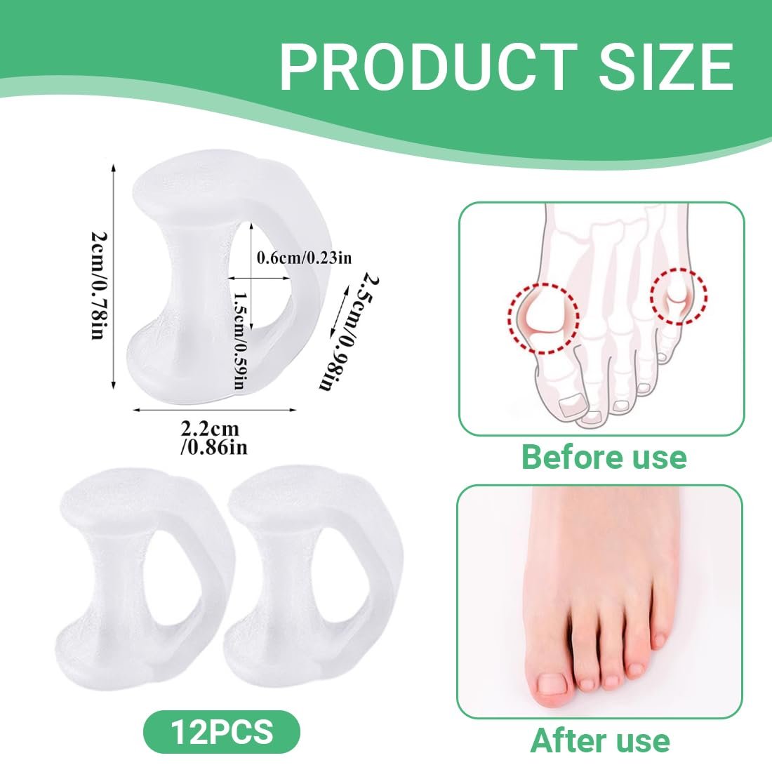 Роздільник для пальців ніг (12 шт. в упаковці) для малого пальця ноги, фото №2
