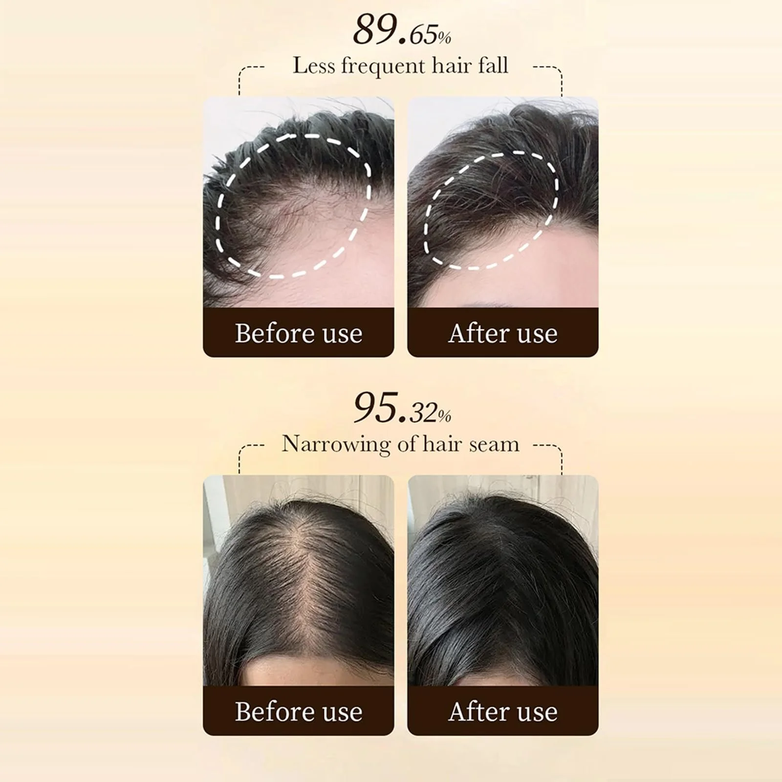 Сироватка для росту волосся, проти випадіння волосся, 2 шт. в упаковці, фото №5