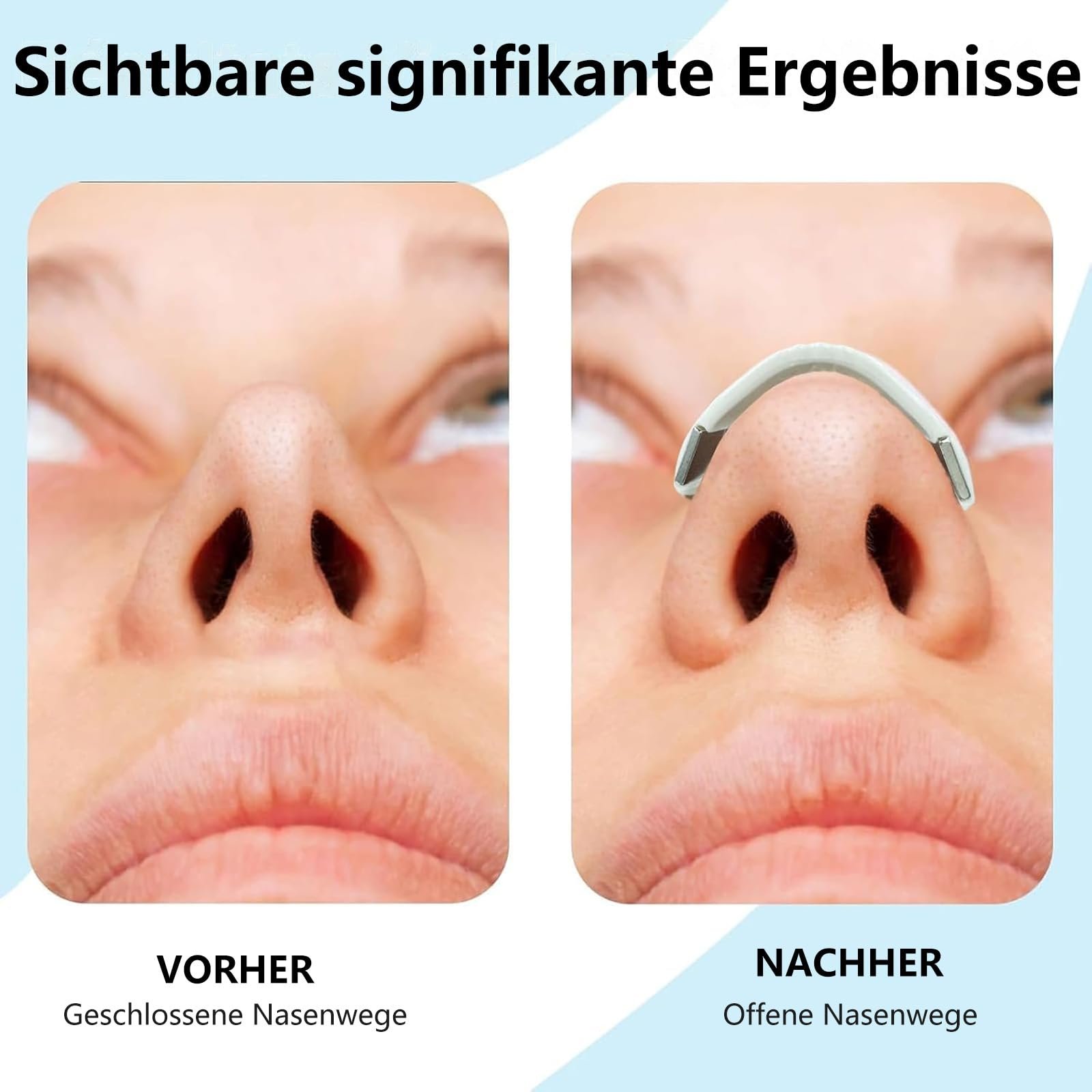 Магнітні назальні пластирі проти хропіння Gymside Airbreeze Pro 2.0 Original, фото №5