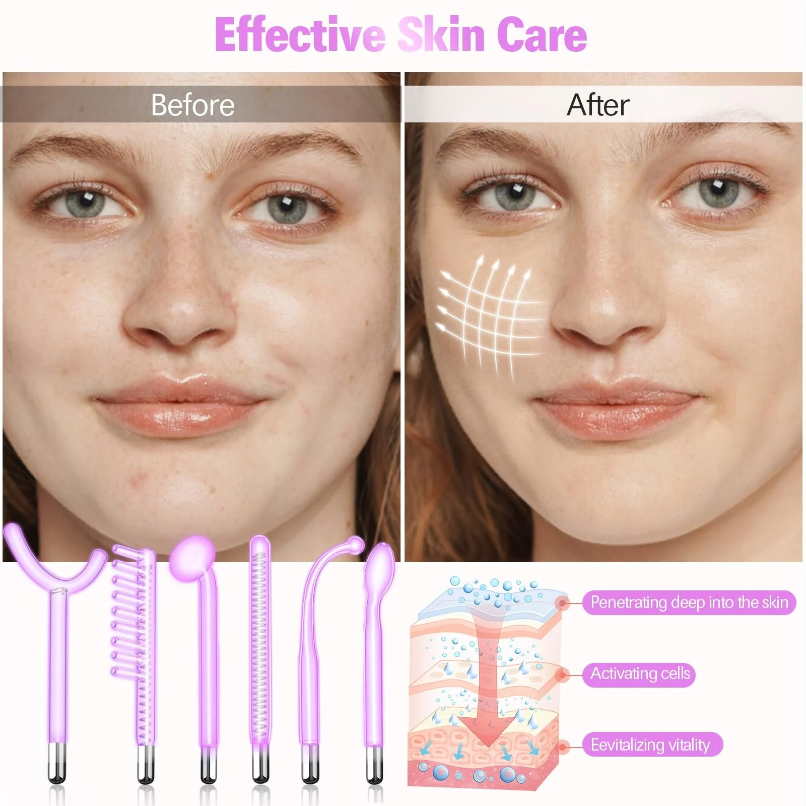 Апарат для високочастотної терапії обличчя 6 аргонових електродів Скляні трубки портативний, фото №3