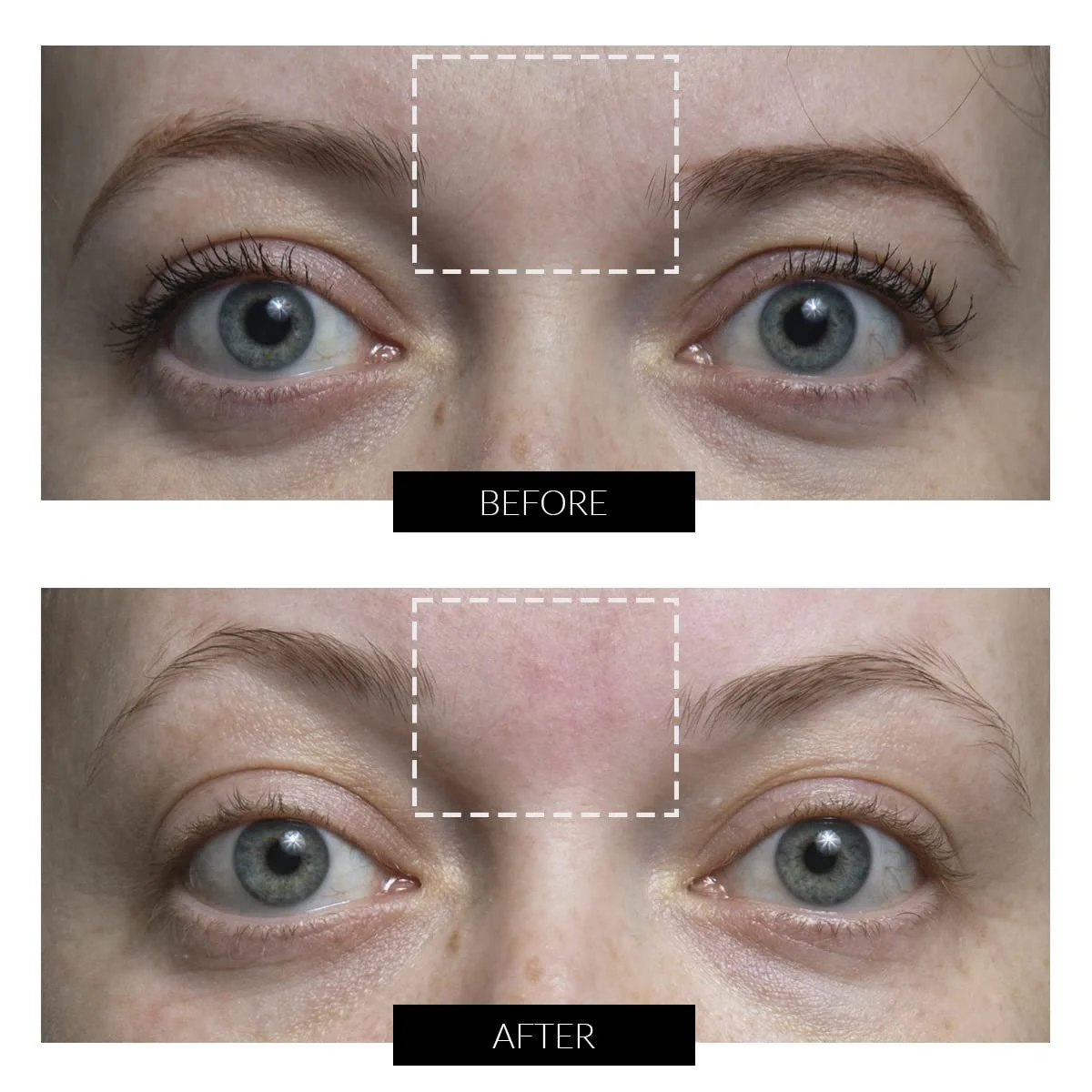 Високочастотний прилад для обличчя CurrentBody Skin, фото №9