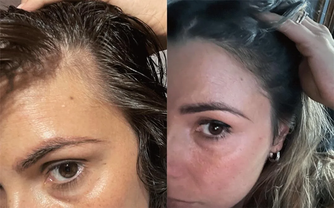 Лосьйон проти випадіння волосся Tricostrong Stanartis 100 мл, фото №7