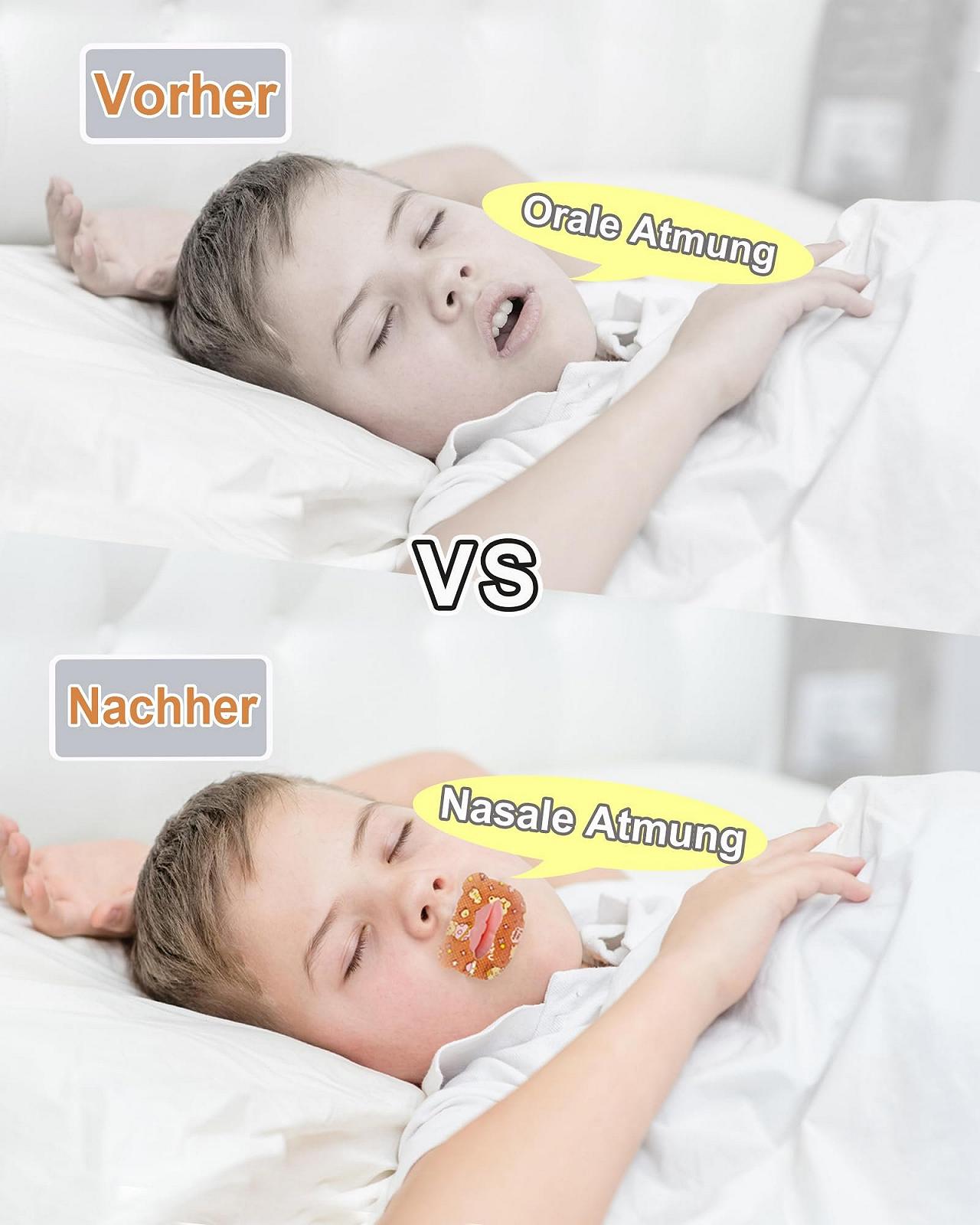 Пластир для рота для дітей для сну, уникнення аденоїдного обличчя, подолання дихання ротом, фото №6