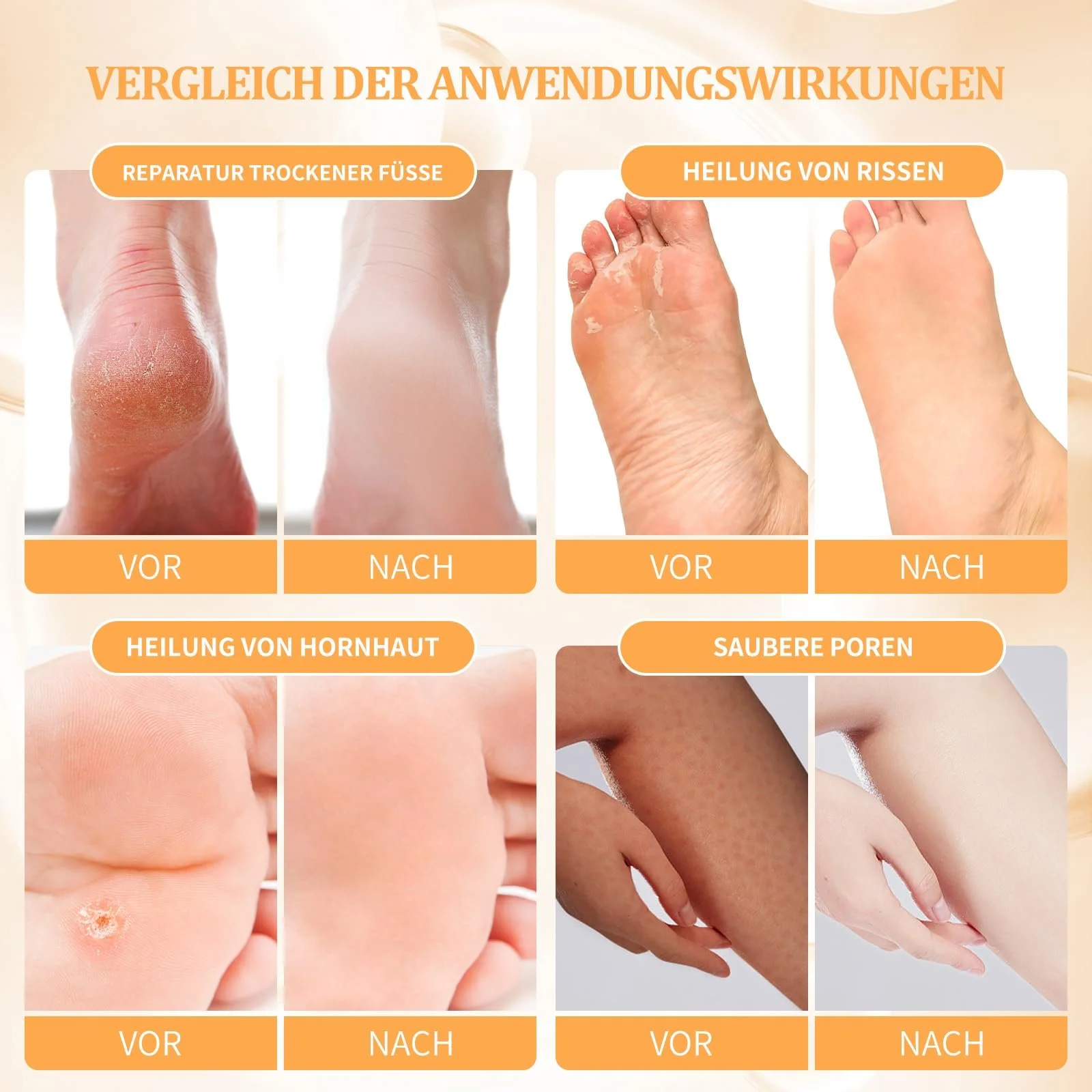 Набор для ухода за ногами 4 Steps Foot Care Citrus 1 Set, фото №3 Набор для ухода за ногами 4 Steps Foot Care Citrus 1 Set, фото №3