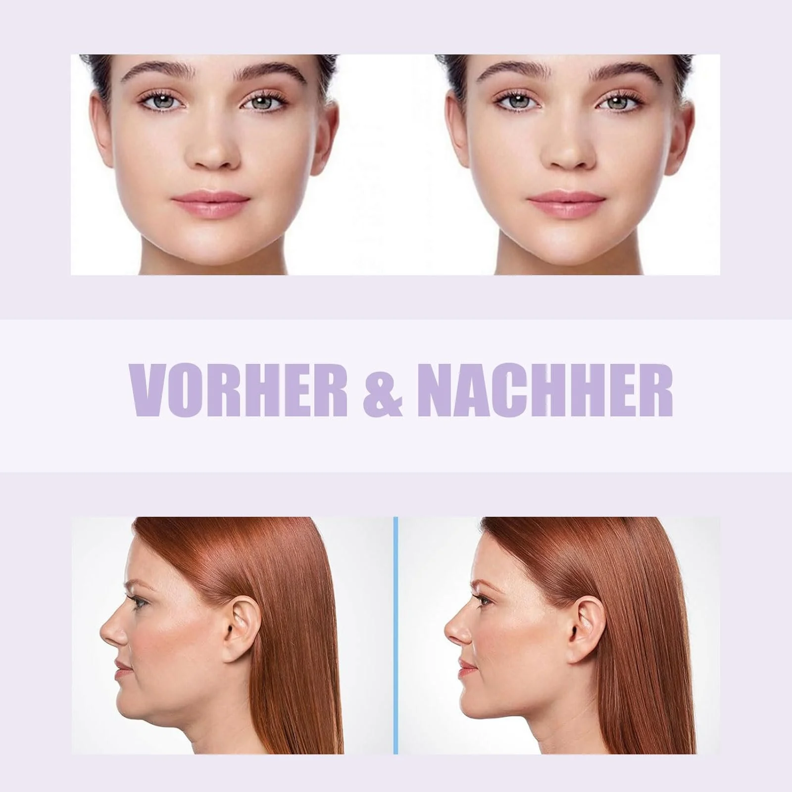 Маска Altherona для видалення подвійного підборіддя, ліфтинг, фото №7 Маска Altherona для видалення подвійного підборіддя, ліфтинг, фото №7