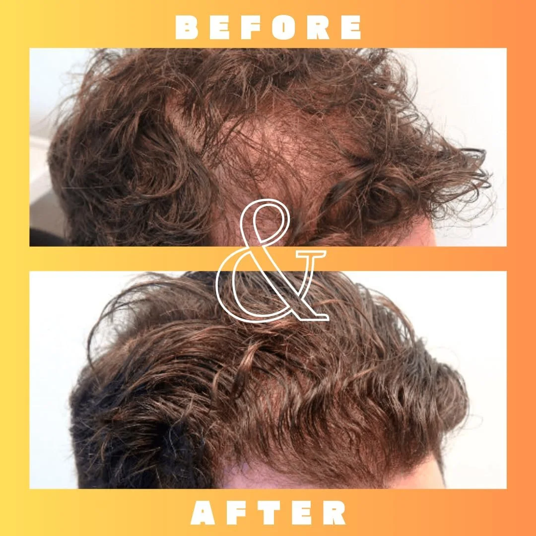 Розчин Mettle Mane RU58841 5% (50 мг/мл) - Передове лікування випадіння волосся, фото №6