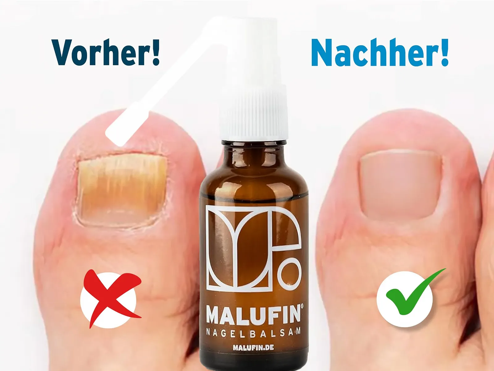 Спрей від грибка нігтів PAULA BRAND Malufin Ефективний засіб 100% натуральний, фото №2