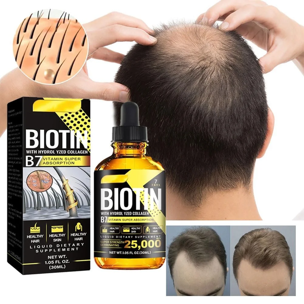 Сироватка для росту волосся, B7 Біотин, 30 мл, для жінок та чоловіків, проти випадіння, фото №8 Сироватка для росту волосся, B7 Біотин, 30 мл, для жінок та чоловіків, проти випадіння, фото №8