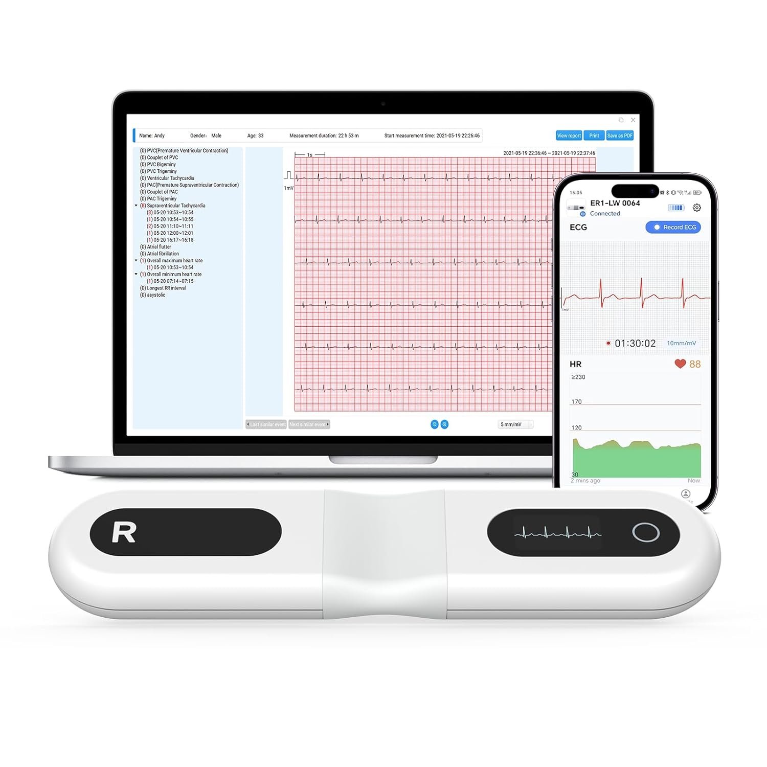 Устройство для долгосрочной ЭКГ Wellue ER1-LW 24 Белый, фото №1 Устройство для долгосрочной ЭКГ Wellue ER1-LW 24 Белый, фото №1
