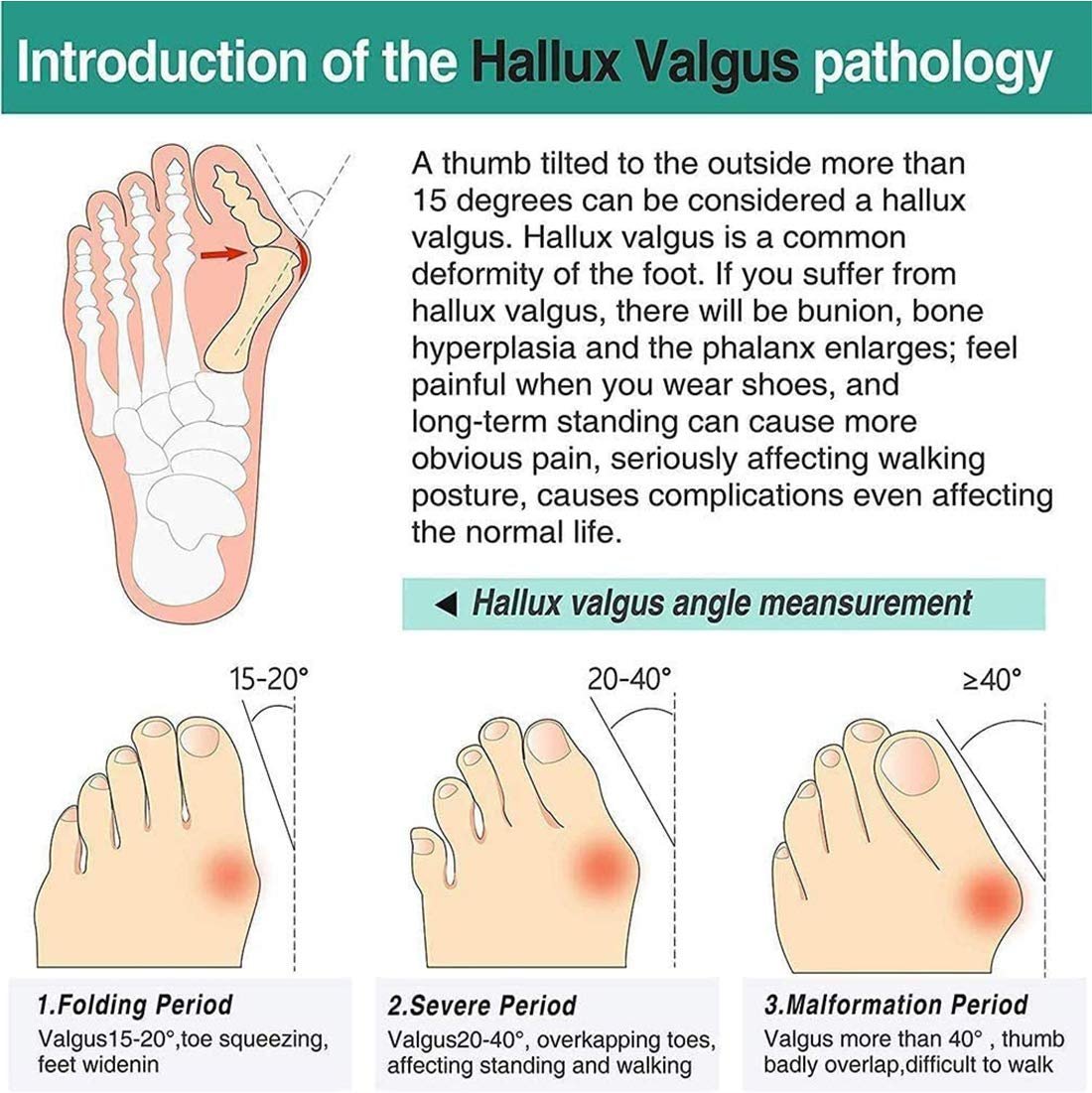 Шлепанцы CrEev Кожаные Женские, фото №8