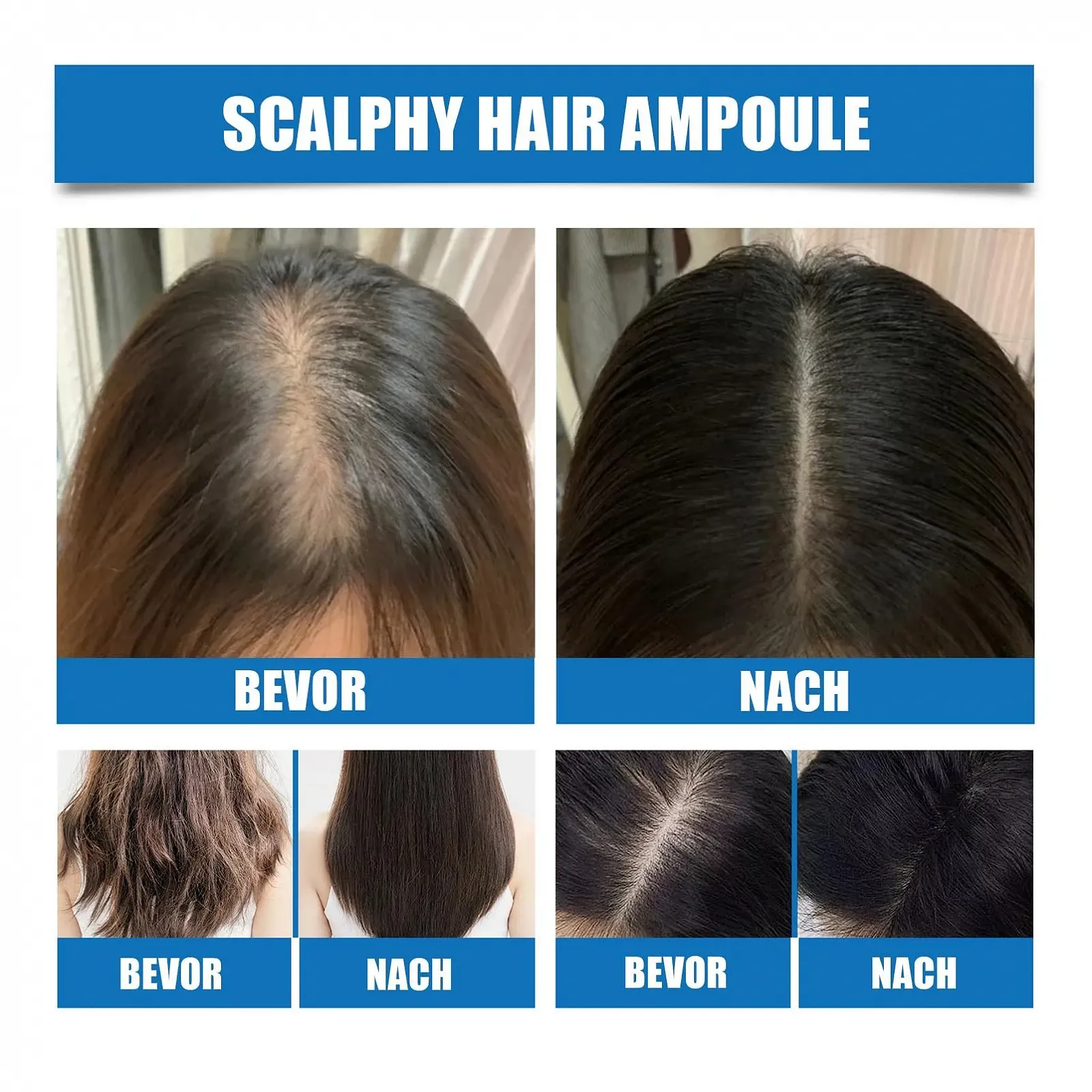 Ампула для волосся Scalphy, Охолоджуюча ампула для росту волосся, фото №3