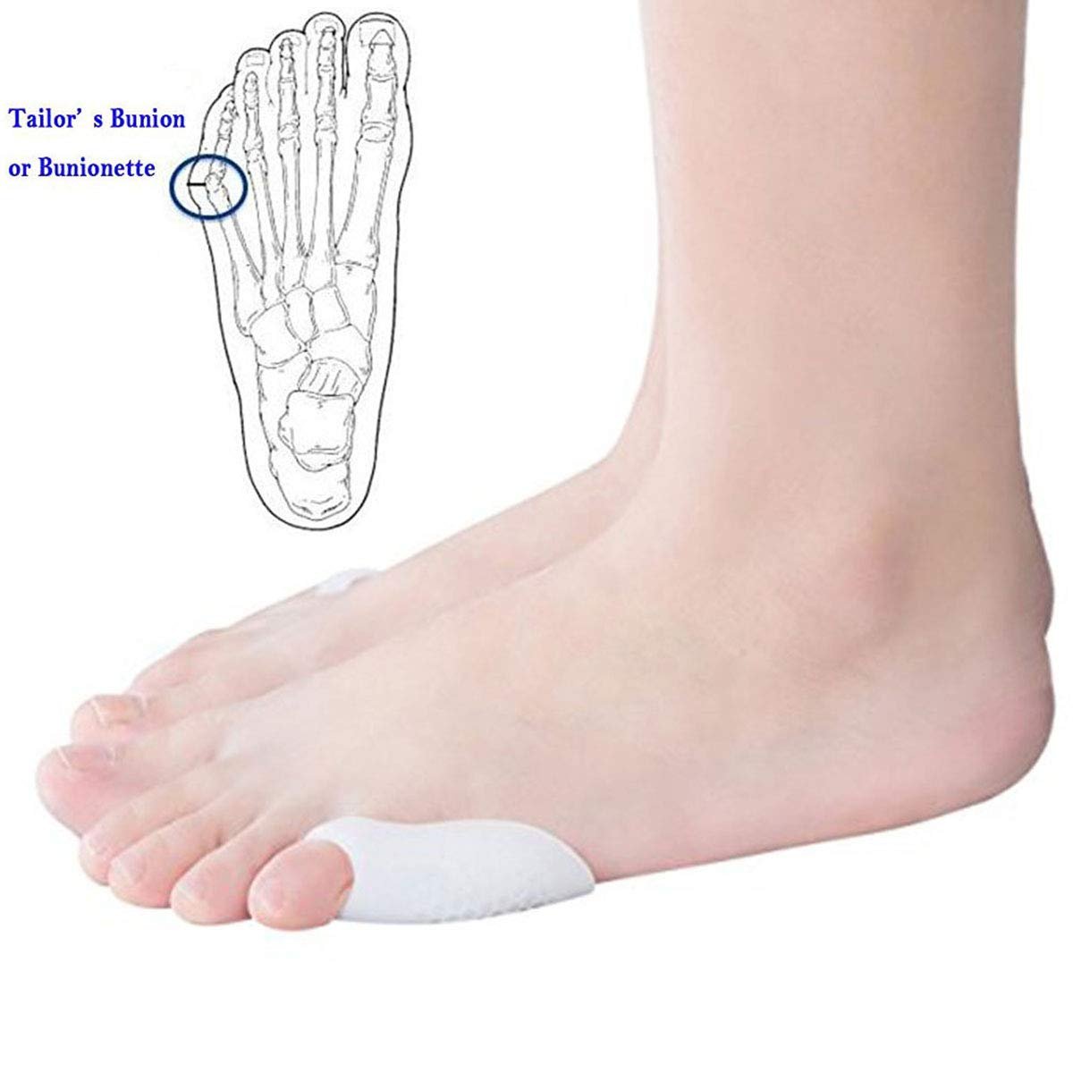 Гелеві подушечки Pedimend для полегшення бурситу Тейлора, коректор Buninette, протектор для випрямлення мізинцz, фото №4