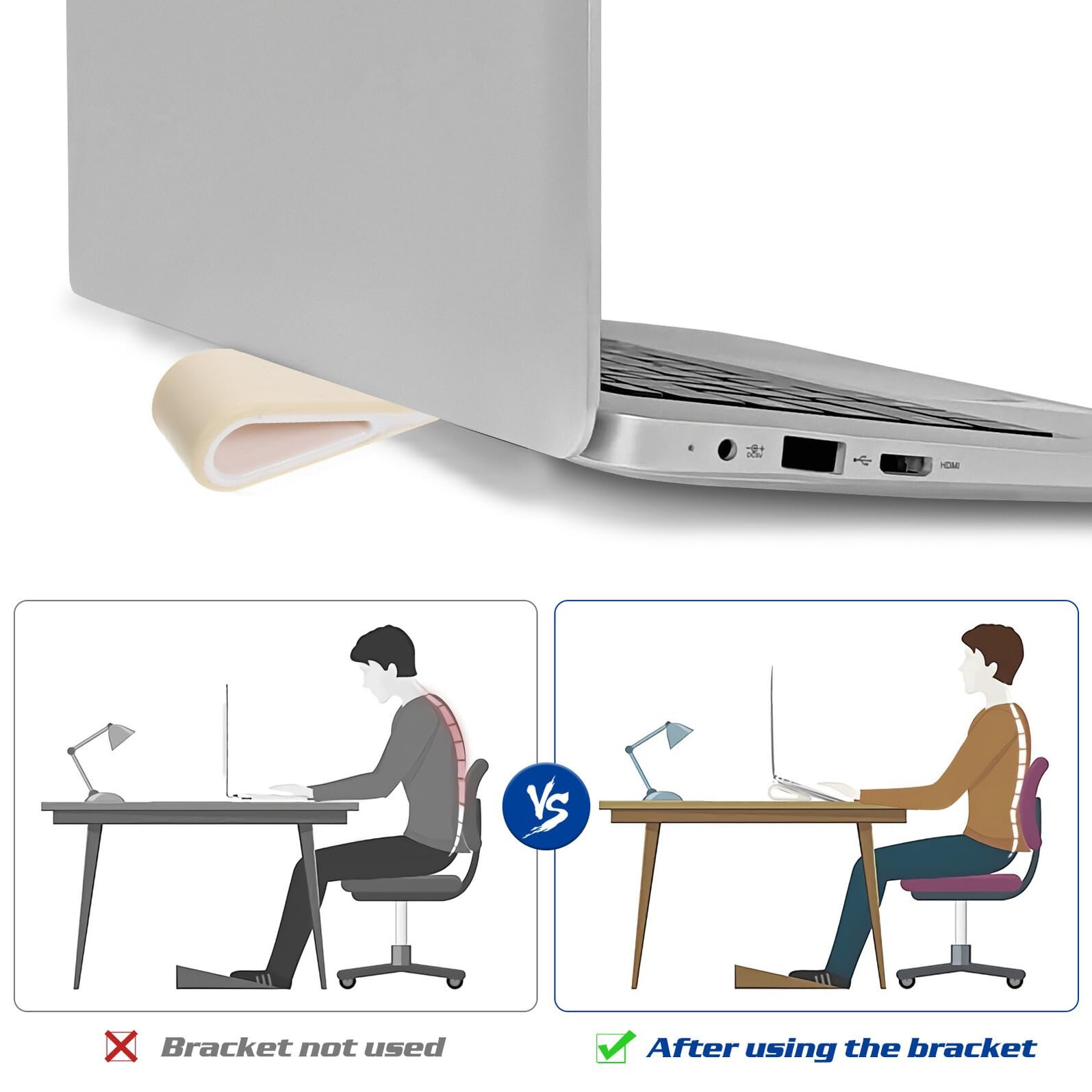 Підставка для ноутбука Ipetboom, 2 шт., Легка силіконова з організацією кабелів, портативна, фото №5