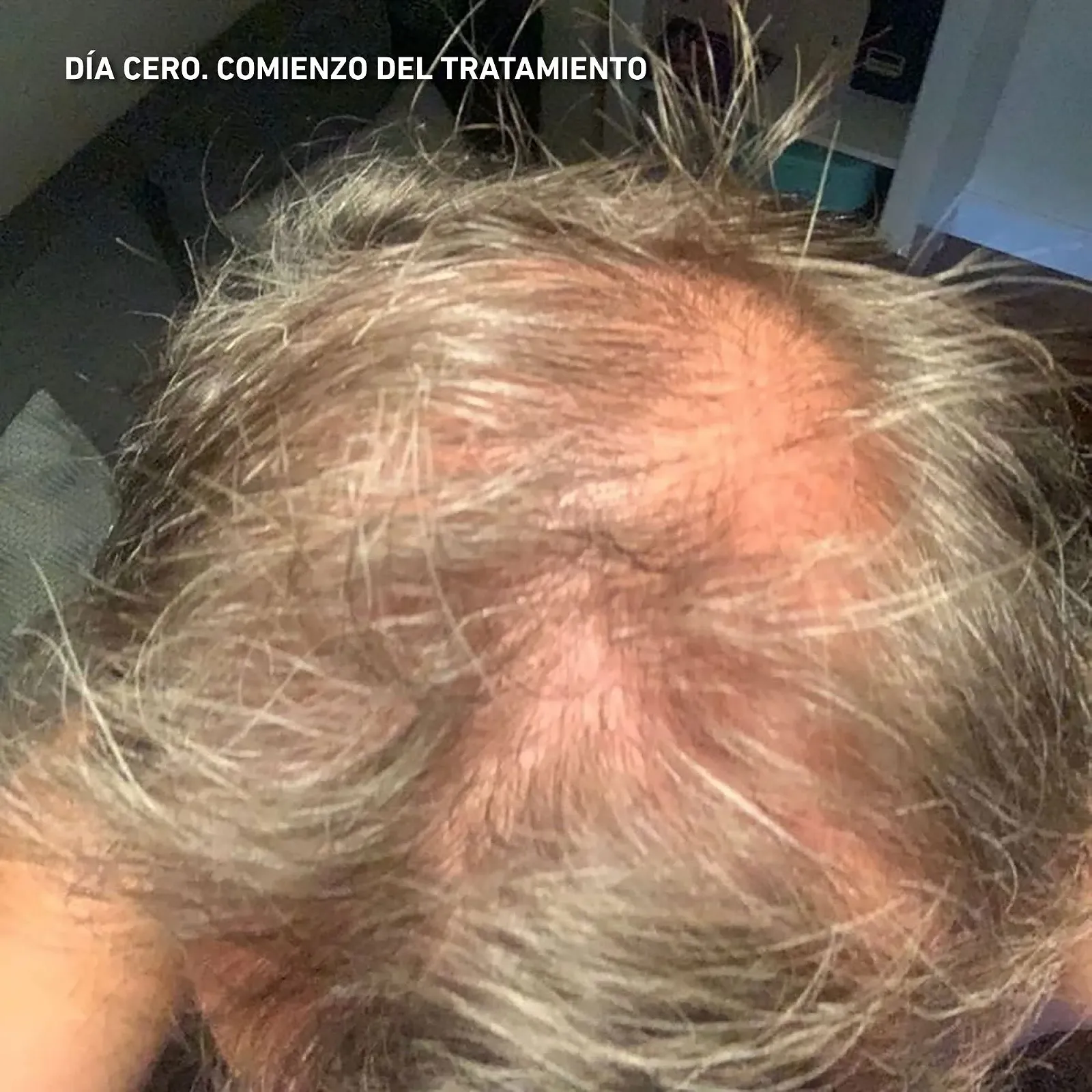 Лосьйон HEY JOE! Power Чоловічий лосьйон проти випадіння волосся 150 мл, фото №2 Лосьйон HEY JOE! Power Чоловічий лосьйон проти випадіння волосся 150 мл, фото №2