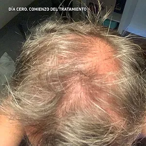 Лосьйон HEY JOE! Power Чоловічий лосьйон проти випадіння волосся 150 мл synthetic.ua - Фото 1