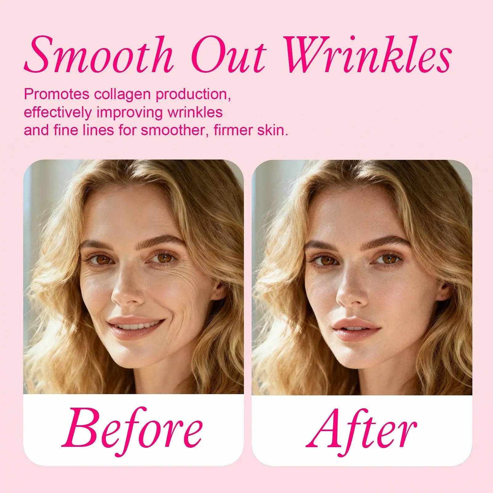 Система мікроінфузій Micro Infusion System, Сироватка для мікронідлінгу, Набір для мікронідлінгової інфузії для підтяжки шкіри, фото №5